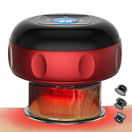 Estefanlo 4-in-1 Smart Cupping Therapy Set with Heat, 12 Dynamic Suction Modes & 3 Heat Levels - $19.99 AC